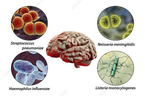 meningite bacteriana agente etiológico